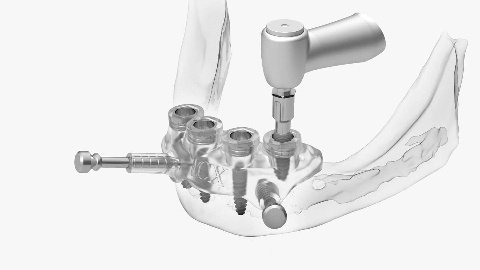 ICX-P5 Intraoral Scanner